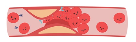 やまぐち内科　高血圧